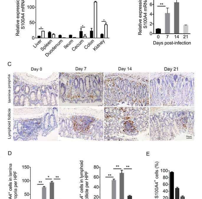 S100A4 contributes to colitis development by increasing the adherence of Citrobacter rodentium in intestinal epithelial cells