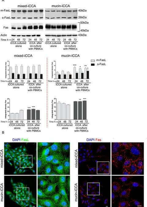 Activation of Fas/FasL pathway and the role of c-FLIP in primary culture of human cholangiocarcinoma cells