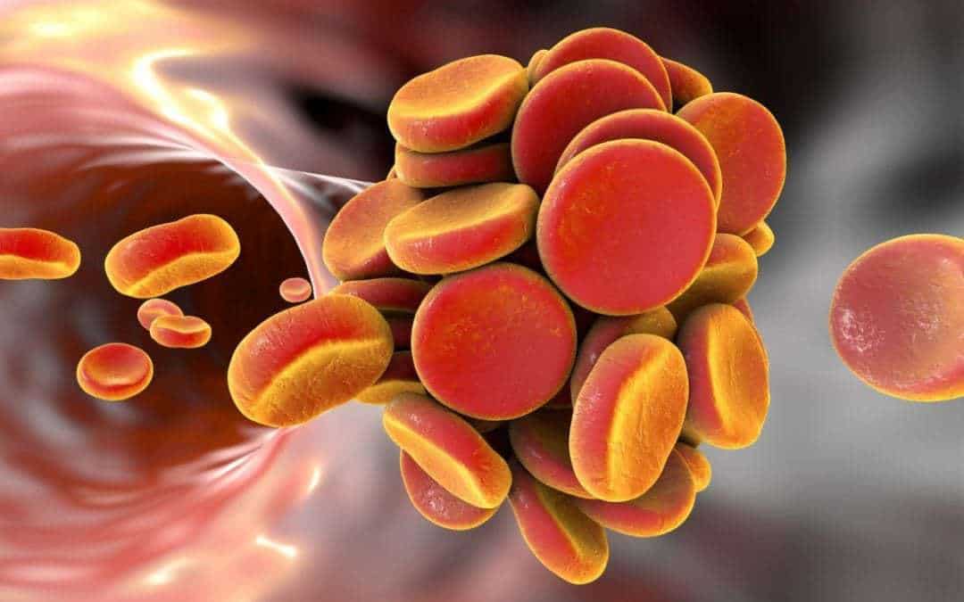Common allergy drugs may prevent blood clots