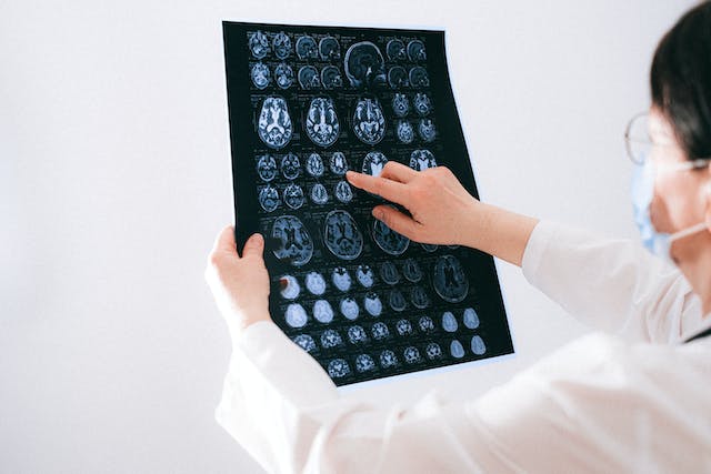 Doctor studying scans to understand neurological disorder. 